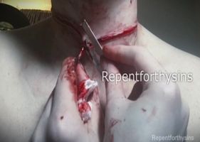 Guy cut his own throat Photo 0001