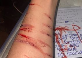 Some old scars and some new ones Photo 0001