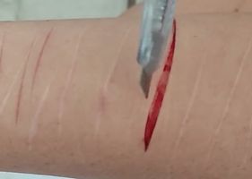 Cutting my arm Photo 0001