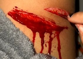 Cutting my arm and blood squirts out 0_o Photo 0001