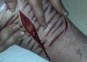 Cutting deep in my leg PT1 Photo 0001
