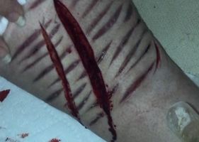 Cutting deep in my leg PT2 Photo 0001