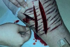 Cutting deep in my leg PT4 Photo 0001
