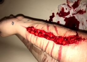Self mutilation slideshow Photo 0001