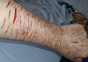 Just some self harm, not really much tho Photo 0001