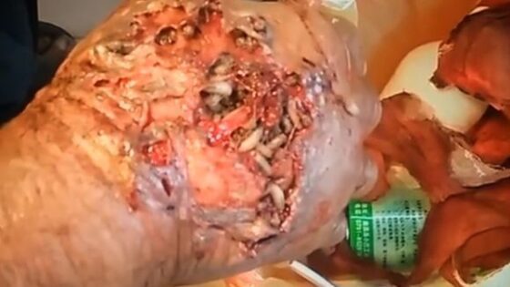 A hand full of maggots, literally Photo 0001 Video Thumb