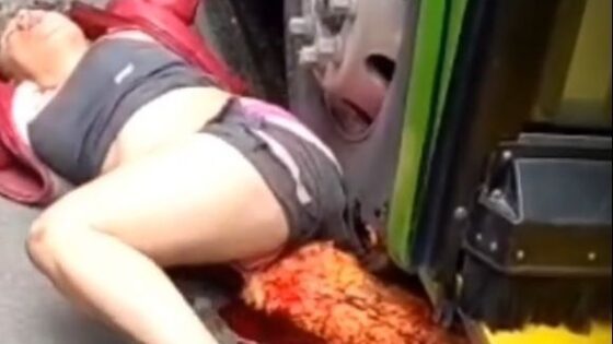 Bus crushes leg of woman in Colombia who was thrown to the ground in pain Photo 0001 Video Thumb
