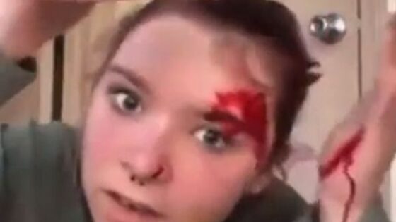 TikToker stabs herself in the head Photo 0001 Video Thumb
