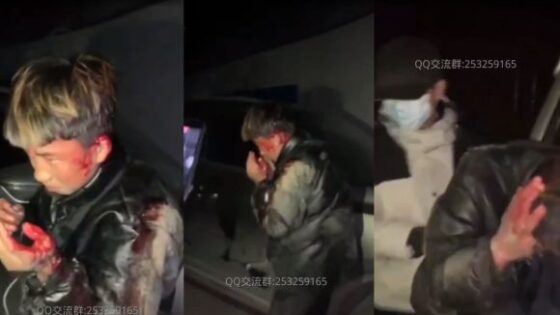 Teenagers beating and bullying Photo 0001 Video Thumb