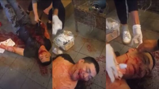 Man got stabbed with broken bottle glass during fight Photo 0001 Video Thumb