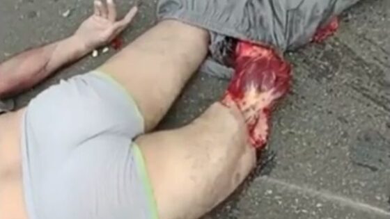 Motorcycle man killed Photo 0001 Video Thumb