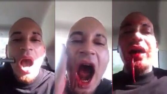 Rapper shoots himself through the mouth as a bid for fame Photo 0001 Video Thumb