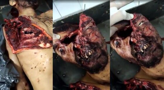Gruesome footage from morgue Photo 0001 Video Thumb