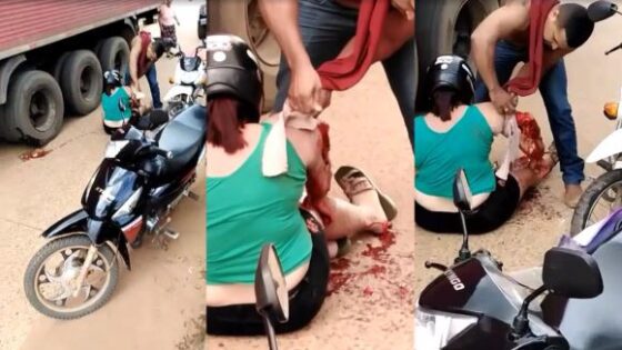Woman arm crushed by truck in brazil Photo 0001 Video Thumb