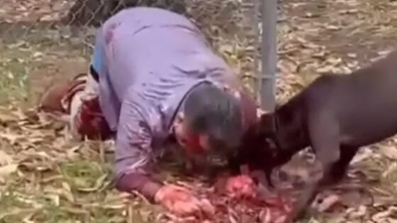 A pit bull ripped a mans arm open Photo 0001 Video Thumb