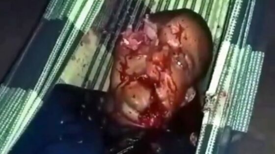 Male shot and killed while sleeping his right eye totally obliterated natal brazil Photo 0001 Video Thumb