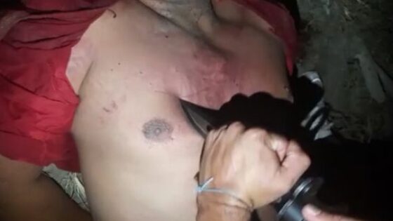 Man has a mark on his chest made with a knife by a member of a rival faction Photo 0001 Video Thumb