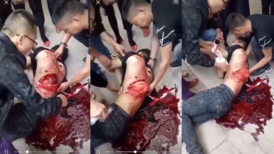 Man has his internal organs being expelled from his body in china after an accident Photo 0001 Video Thumb