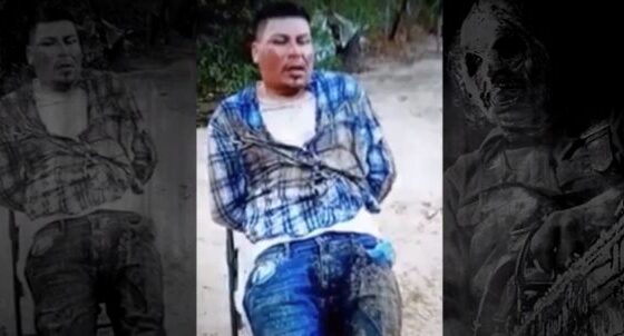 Man has his legs cut off with a chainsaw by cartel members Photo 0001 Video Thumb