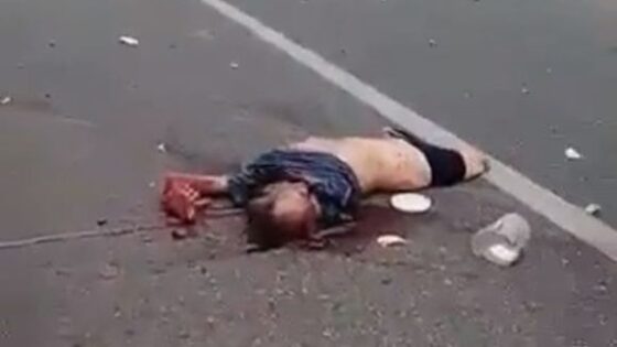 Man tragically cut into a few parts in accident Photo 0001 Video Thumb
