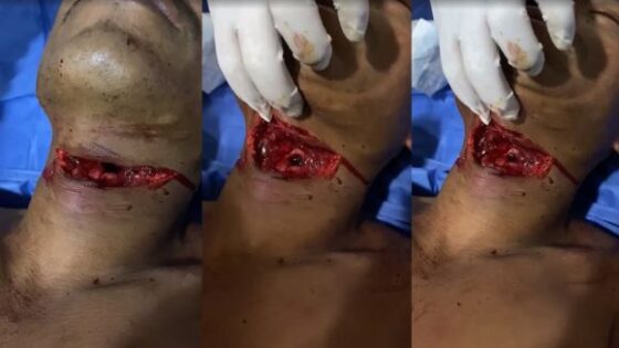 Mans neck slashed with knife and still alive Photo 0001 Video Thumb