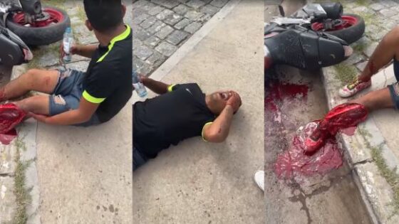 Motorcyclist leg tragically ripped off in accident Photo 0001 Video Thumb