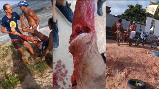 Shark attack aftermath in olinda brazil Photo 0001 Video Thumb