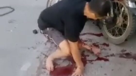 Terrifying moment when man trying to stand with broken leg Photo 0001 Video Thumb