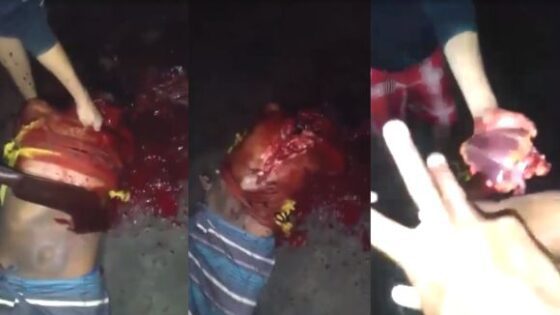 The body of a decapitated man was gutted and organs cut out Photo 0001 Video Thumb