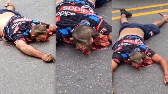 Biker head tragically split up in accident Photo 0001 Video Thumb