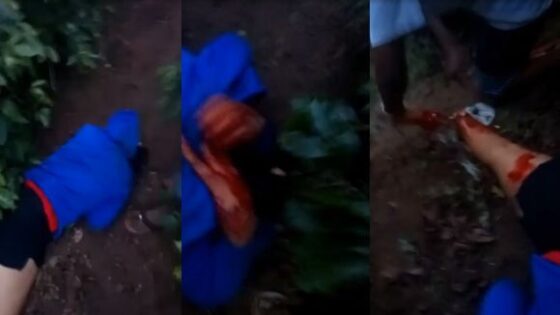 Brazilian girl was cut off her foot and stabbed by gang Photo 0001 Video Thumb