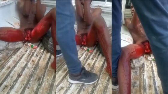 Dude cuts off his genital after stabbing girlfriend Photo 0001 Video Thumb