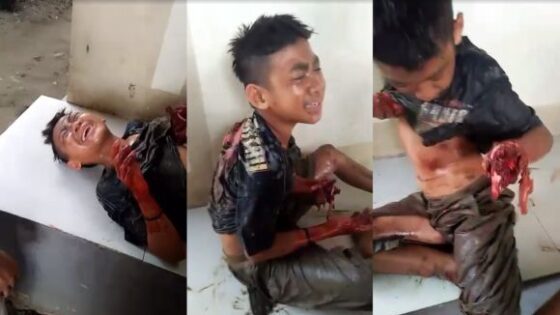Indonesia boy hand got blown off child warning Photo 0001 Video Thumb