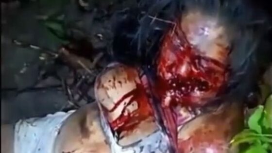Woman still alive with great part of face ripped off after machete attack Photo 0001 Video Thumb