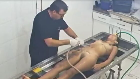 Young undressed dead woman embalming case 15 Photo 0001 Video Thumb