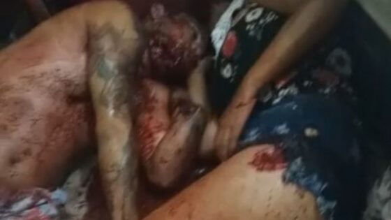 Woman groaning in pain after being attacked with a knife in brazil and left barely alive on the ground Photo 0001 Video Thumb