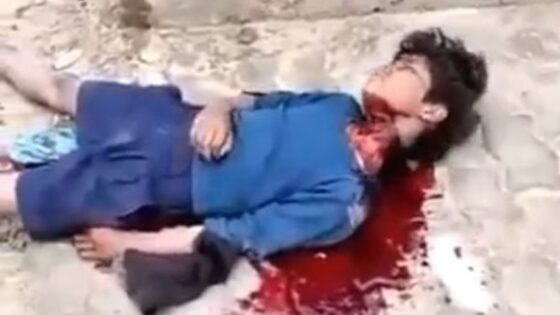 Child warning indian kid has throat slit and bleeds to death context in description Photo 0001 Video Thumb