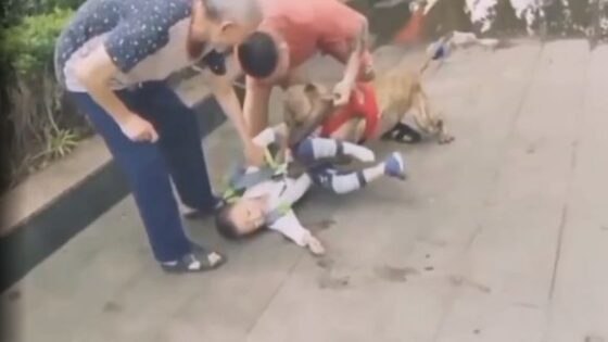 Kid attacked and bitten by dog Photo 0001 Video Thumb