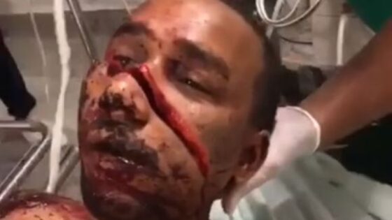 Man still alive after got chopped on face Photo 0001 Video Thumb