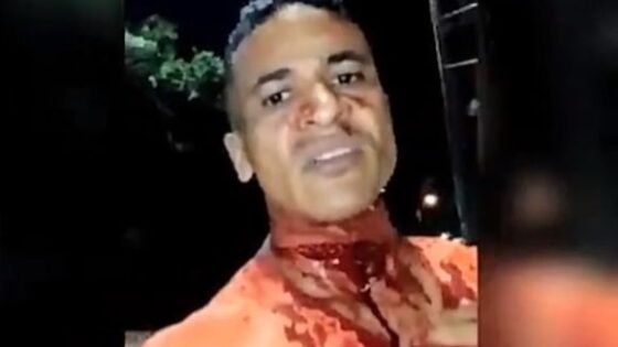 Man throat got cut but still alive Photo 0001 Video Thumb