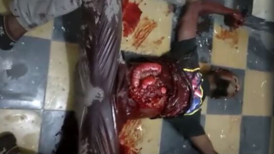 Man with his stomach ripped open and guts sticking out writhing in pain on the ground Photo 0001 Video Thumb