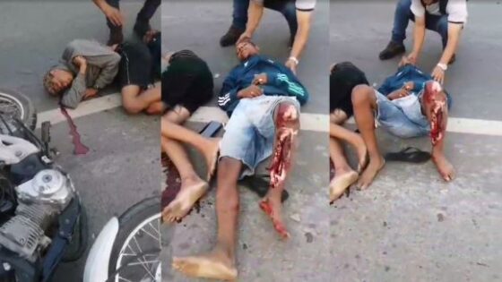 Young woman destroyed after crashing on a motorcycle Photo 0001 Video Thumb