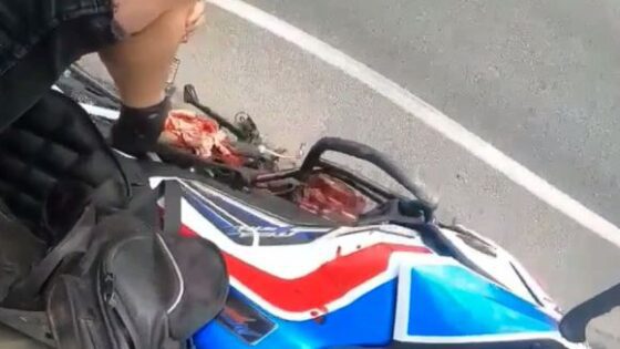 Bikers leg was crushed due to the accident Photo 0001 Video Thumb