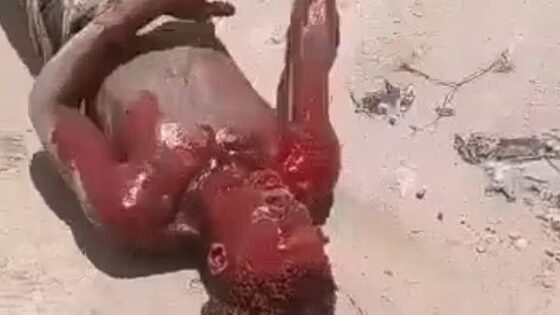 Haitian dragged and cut to death Photo 0001 Video Thumb