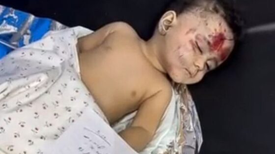 Child alert october 2023 innocent children died in gaza al shefa hospital Photo 0001 Video Thumb