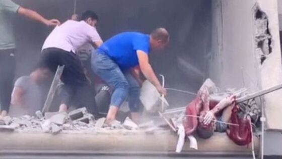 Horrifying images of a civilian rescued from rubble in northern gaza Photo 0001 Video Thumb