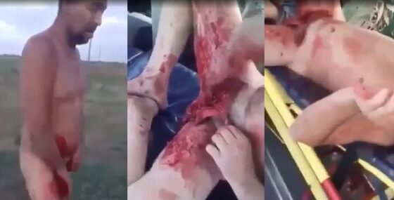 Man brutally cut off his own genitals Photo 0001 Video Thumb