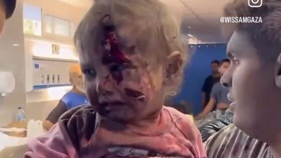 Palestinian little girl sustains serious injuries in an israeli airstrike on gaza Photo 0001 Video Thumb