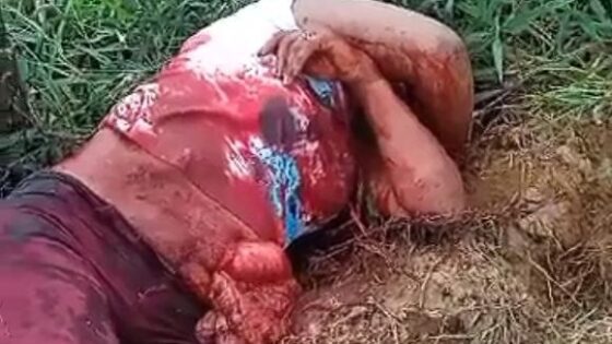 Womans belly destroyed by husband in horrific murder attempt Photo 0001 Video Thumb