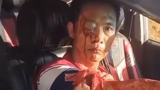 Chinese taxi driver is victim of armed robbery and is extremely injured Photo 0001 Video Thumb